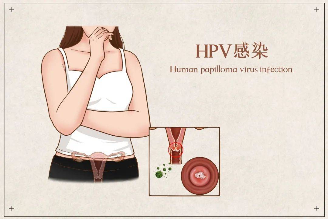 了解性传播疾病才能针对性做好预防工作